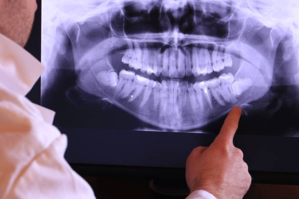 Best Emergency Treatment for Toothache in Beatrice, NE